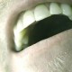 A reflux fogak tekintetében lassan károsító hatást fejt ki